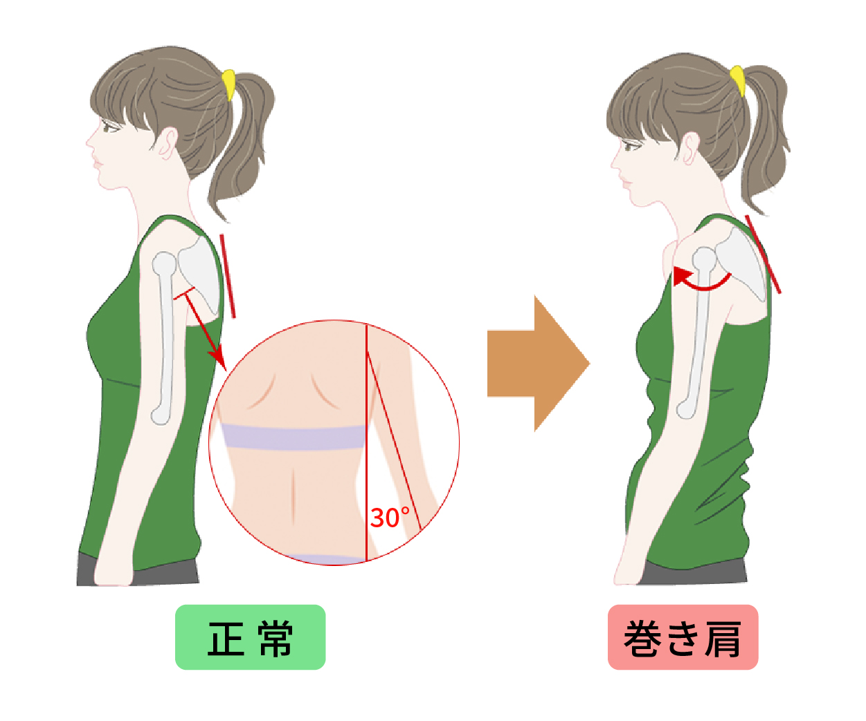 骨格の歪み