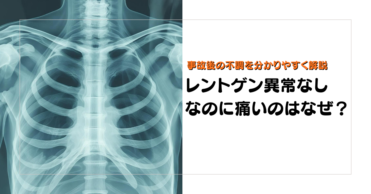 みらい平Life Fun鍼灸接骨院のブログ用アイキャッチ。交通事故後、レントゲンで異常なしと言われたのに痛みが続く理由を解説するデザイン。